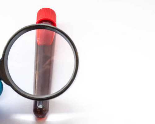 宫外孕的高发人群有哪些