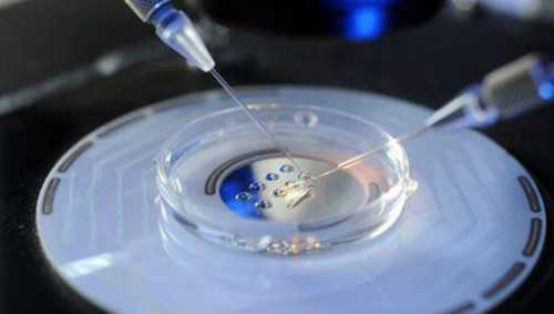 30+备孕一胎，四促失败