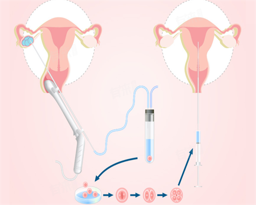 小产后如何调理身体恢复的快？做好6个方面护理，让你快速恢复