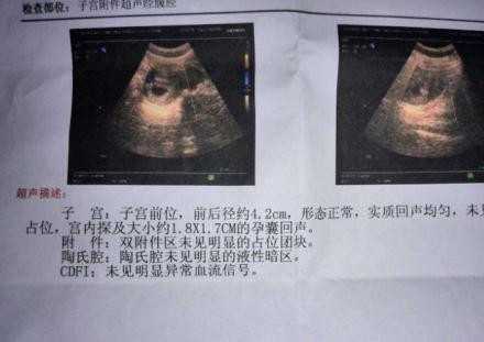 合法北京代孕服务好的商家,妇科疾病多是拖出来