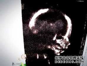 北京借卵子生子哪里好,北京供卵试管生子有保障吗,北京公立医院供卵成功