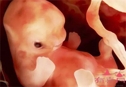 北京试管婴儿供卵中心~北京供卵中心找~，带环怀孕后需要取环吗