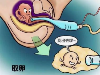 北京aa69捐卵，北京治疗卵巢早衰医院有哪些